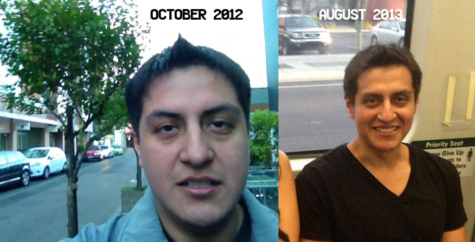 Jorge Before and After Hypothyroidism Face